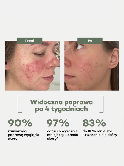 Tallow Naturals – Dla skóry suchej